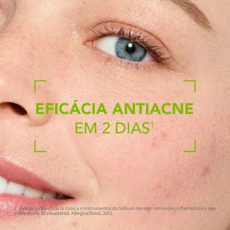 Gel-Creme Antiacne e Anti-Marcas Bioderma Sébium Kerato+ – 30ml